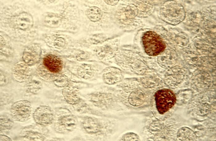 16924