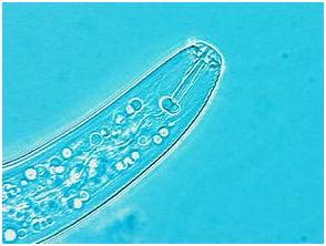 Pratelenchus penetrans 5671